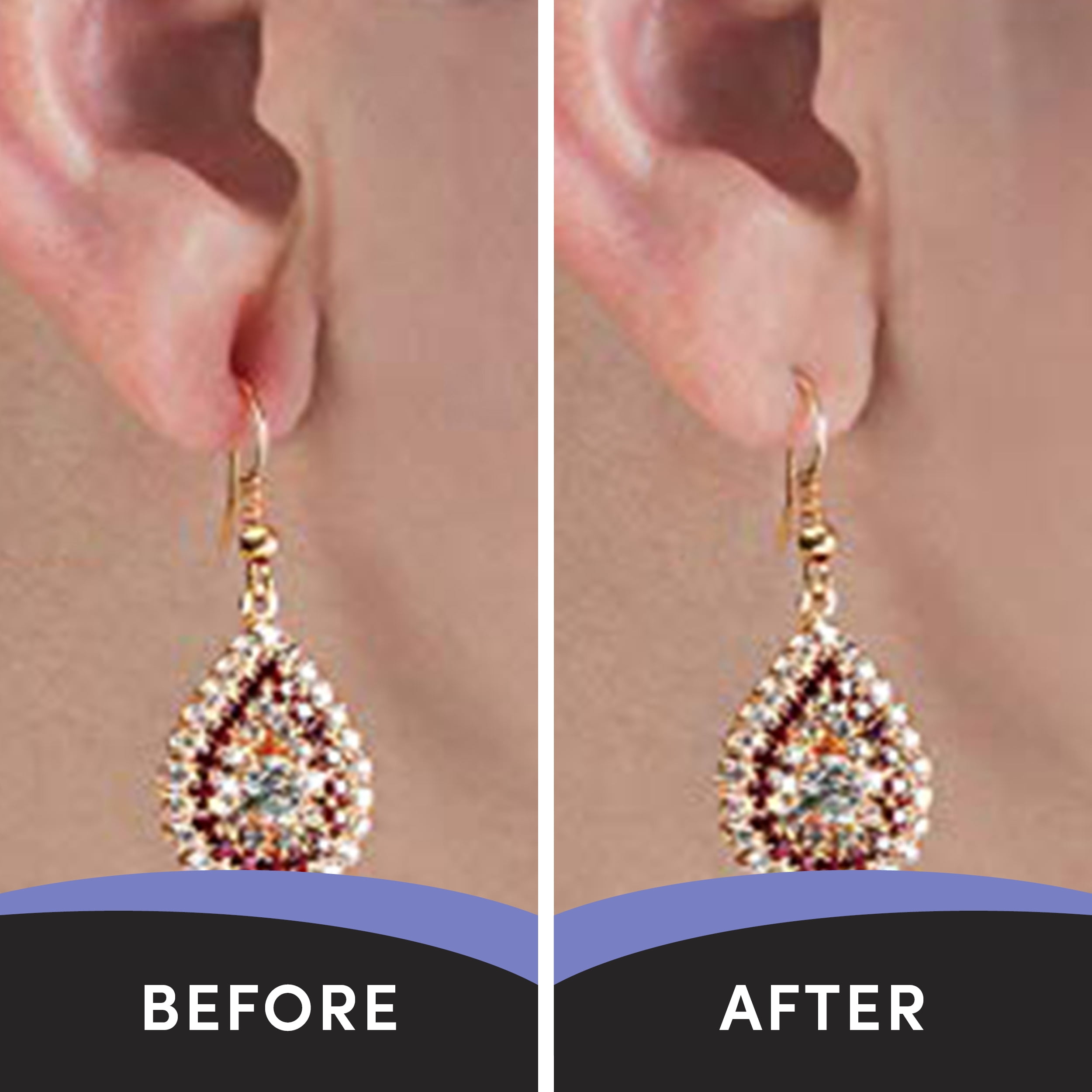 Quick fix for Stretched EarLobes at home without Surgery ! - %