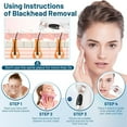 thumbnail image 4 of JUUTREN Blackhead Remover Pore Vacuum for Face, Water Cycle Facial Pimple Pore Cleanser with 3 Suction Levels, 6 Heads for Deep Cleansing & Skin Care, Electric Facial Cleansing Tool for Women & Men, 4 of 7