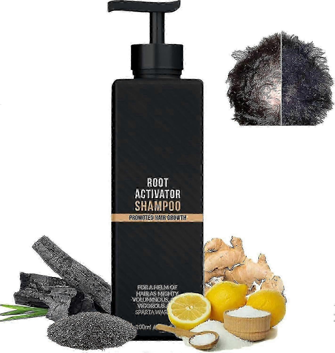Root Activator Shampoo, Mane Root Activator Shampoo, Shampoo Root Activator Promotes Hair Growth