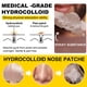 thumbnail image 5 of 12 Uds. Parche nasal para eliminación de espinillas, tiras hidrocoloides para la nariz, limpieza de poros, parches para el acné, 5 of 8
