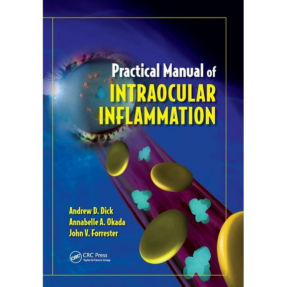 Practical Manual of Intraocular Inflammation, (Paperback)
