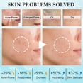 thumbnail image 2 of Kit de rutina para el cuidado de la piel facial para mujeres y adolescentes, 2 of 7