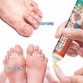 thumbnail image 4 of Fungal Foot Cream for Itch Relief, Anti-Fungal Skin Treatment, Effective Antifungal Solution for Feet and Skin Care, 4 of 5