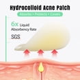 thumbnail image 6 of Ourmed Life 106Ct 7 Sizes Pimple Patches Variety Pack Hydrocolloid Acne Patches with Tea Tree Oil for Face Body & Acne Clusters, 6 of 10