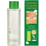Troubless Essence de Toner Doux Clair - Toner Facial à l'Arbre à Thé pour Tous Types de Peau / Toner Hydratant, Soin Quotidien de la Peau (6.76 fl oz)