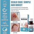 thumbnail image 4 of Liquid Bandages, Liquid Skin Glue For Wounds Human, Waterproof Breathable Quick Dry Wounds Care Gel, Transparent Protective Skin Patch, 4 of 5