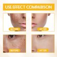 thumbnail image 6 of Komiseup Facial To Lighten Spots And Marks Tone Moisturize And Tighten 30ml, 6 of 9