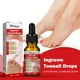thumbnail image 1 of Suavizante de uñas encarnadas Suero Corrección de uñas Recuperar Aceite Analgésico Likrtyny  Cuidado Belleza, 1 of 6