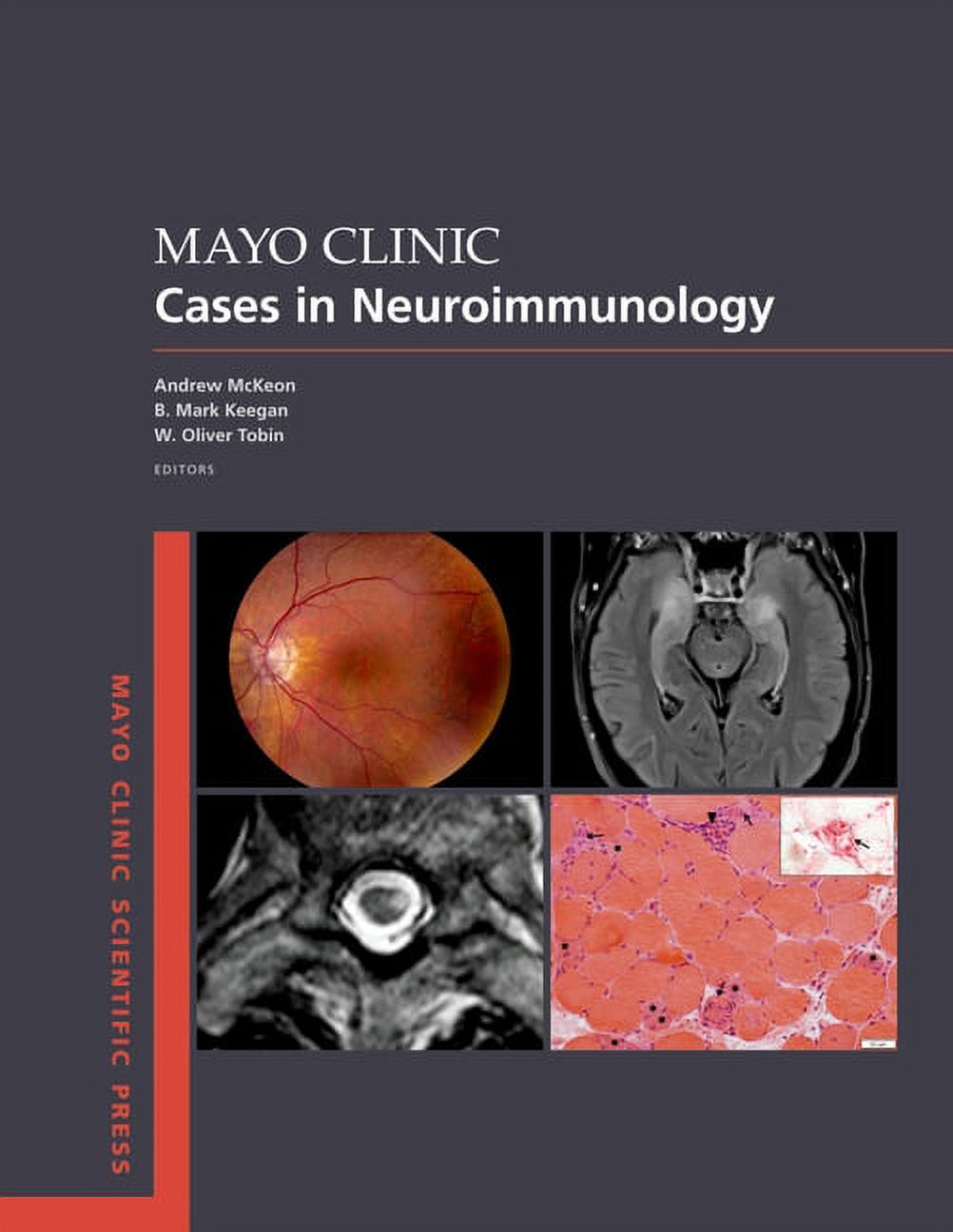 Mayo Clinic Scientific Press Mayo Clinic Essential Neurology