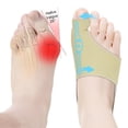 thumbnail image 1 of Corrector Juanete Hallux Valgus Herramientas Ajustables Y Transpirables para El Cuidado Los Pies, 1 of 9