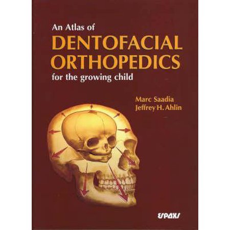 UPC: 9788471792945 | An Atlas of Dentofacial Orthopedics for the Growing Child (Hardcover)