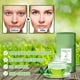 thumbnail image 2 of Mascarilla facial HUOGUO Limpieza Profunda Hidratante Oil Control 4, 2 of 4