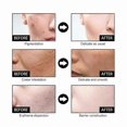thumbnail image 4 of Facial Brightening Essence with Nicotinic Acid for Hydration and Keratin Removal, 50ml, 4 of 5
