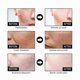 thumbnail image 4 of Facial Brightening Essence with Nicotinic Acid for Hydration and Keratin Removal, 50ml, 4 of 5