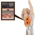 thumbnail image 4 of Magnetic Wrist Support. Waterproof Gel Wrist Thumb Braces. Therapy Wrist Hand, 4 of 4