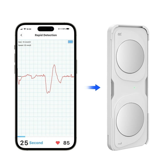 IKeener Portable Smart ECG Monitor Device - Wireless Heart Rate & Arrhythmia Detection for Daily Health Monitoring
