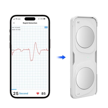 LaseLocks Portable Smart ECG Monitor Device - Wireless Heart Rate & Arrhythmia Detection for Daily Health Monitoring