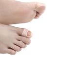 thumbnail image 4 of 5 pares de abrazadera correctora de uñas de silicona Colcomx Corrector de uñas encarnadas, 4 of 8