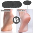 thumbnail image 2 of Vocoste Sandpaper Disk Replacement Pad Foot File Callus Remover Tool Fine  240 Grit 35mm 100 Pcs, 2 of 7