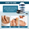 thumbnail image 4 of FUNGINIX Toenail Fungus Treatment Extra Strength - Antifungal Nail Treatment With 10% Undecylenic Acid & Tea Tree Oil - Includes Natural Oils & Botanicals - Made in USA (Packaging Does Vary), 4 of 7