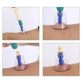 thumbnail image 3 of Milaget Professional Cupping Equipment 24 Cups Set with Pumping Handle & English Manual, 3 of 9