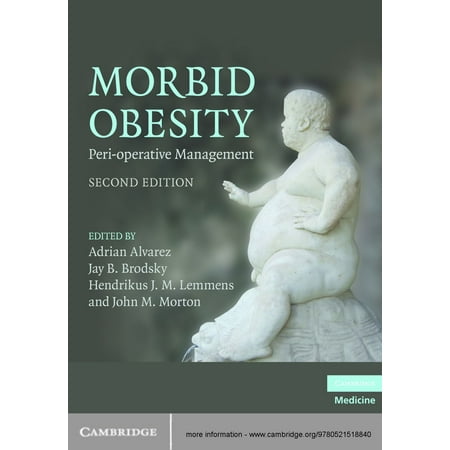 Morbid Obesity Ebook - 