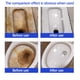 thumbnail image 5 of Toilet Bowl Cleaning Tablets 300g | Urinal Stain Remover Powder | Lime Scale & Discoloration Eliminator | Deodorizing Bathroom Cleaner | High Concentration Formula | Ceramic Toilet Compatible, 5 of 9