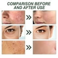 thumbnail image 5 of Aceite esencial de jazmín, aceite de masaje facial hidratante, iluminador, piel con poros sensibles, aceite para piel, 60 ml, aceites de masaje de jazmín, 5 of 5