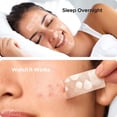 thumbnail image 5 of Hydrocolloid Acne Patch – 7 Sizes, 302 Patches Waterproof Protective Cover for Day & Night Use on Blemishes & Spots, 5 of 6