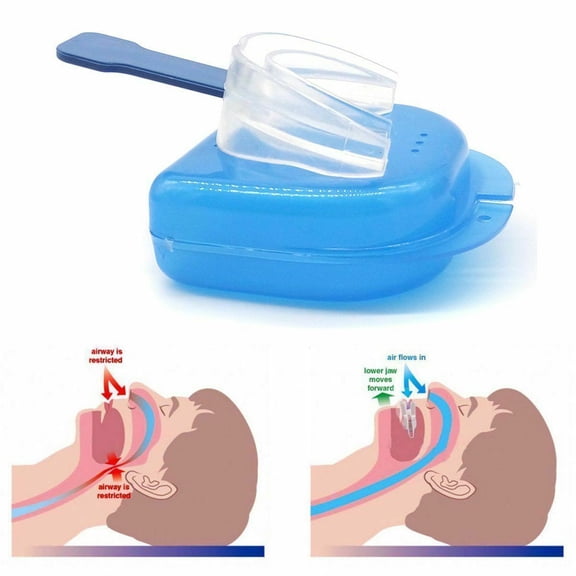 Adjustable Anti-Snoring Device- Effective Snoring Solution – Professional and Reusable Stop Snoring Mouth Guard Sleep Aid