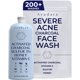 thumbnail image 1 of Ayadara Limpiador Facial de Carbón para Acné Severo, 100 ml, Limpiador Diario con Azufre y Miel, Limpiador Facial para el Acné, Limpiador Facial de Carbón de Limpieza Profunda para Mujeres y Hombres,, 1 of 1