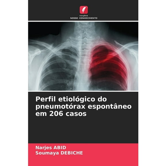 Perfil etiolÃ³gico do pneumotÃ³rax espontÃ¢neo em 206 casos, (Paperback)