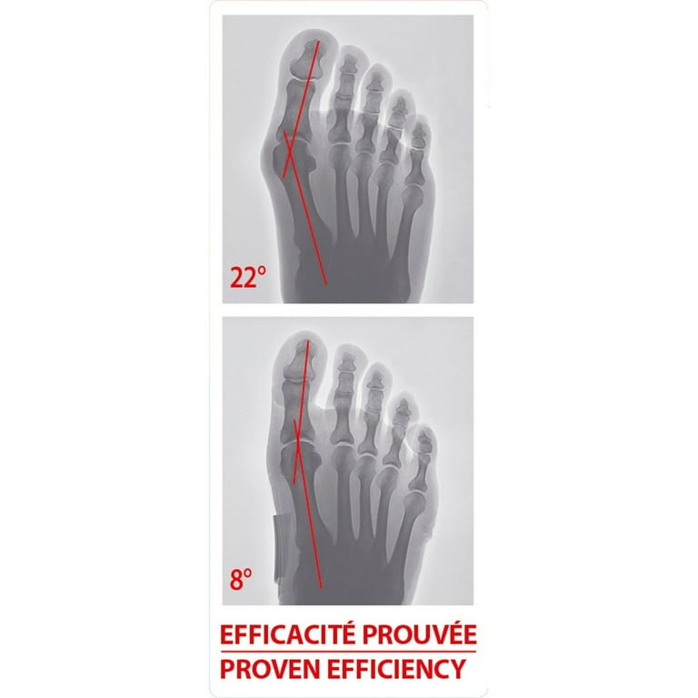 Epitact Bunion Corrector Reviews corona.dothome.co.kr