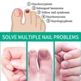 thumbnail image 4 of Tratamiento rápido de hongos en las uñas, suero para el cuidado de esencias, eliminación de hongos en las uñas de los pies, Gel para paroniquia y onicomicosis, 4 of 4