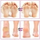 thumbnail image 5 of Removedores de callos para pies Recargable Electronicand Callus Remover con vacío incorporado Hard Cracked Vhermosa CPB-US-YYM397-1, 5 of 5