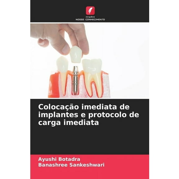 ColocaÃ§Ã£o imediata de implantes e protocolo de carga imediata, (Paperback)