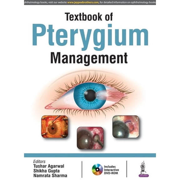 Textbook of Pterygium Management (Paperback) by Tushar Agarwal, Shikha Gupta, Namrata Sharma