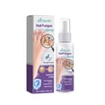 thumbnail image 1 of Spray para hongos en las uñas - Cuidado desodorizante para uñas grises e infecciones por hongos, 100 ml, 1 of 4