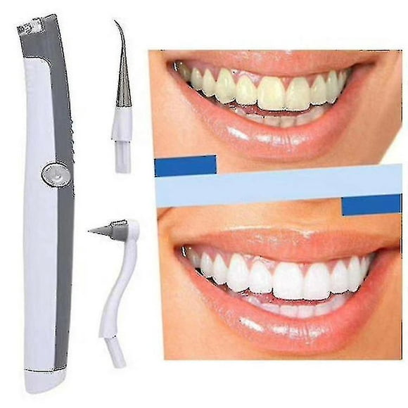 Sonic Dental Scaler Electric Ultrasonic Tooth Stain Plaque Cleaner Teeth Clean