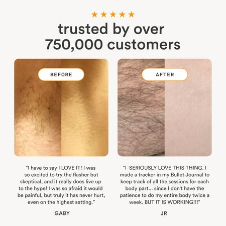 Nood Flasher 2.0 — IPL Laser Hair Removal Device for Women & Men — Pain-Free & Permanent Results