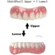 thumbnail image 5 of Upper And Lower Veneer Dentures For Women And Men Fake Teeth Natural Shade! Fix Your Smile At Home Within Minutes!, 5 of 5