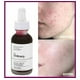 thumbnail image 2 of Serum Peeling Solution The Ordinary AHA 30% + BHA 2%, 2 of 2
