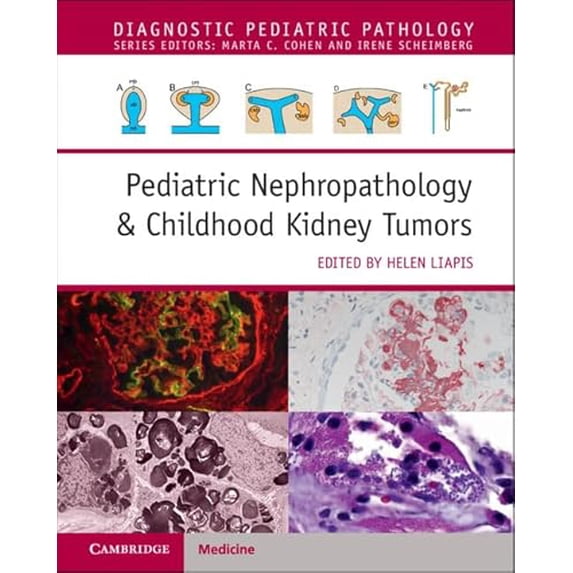 Pre-Owned Pediatric Nephropathology & Childhood Kidney Tumors with Online Resource (Diagnostic Pediatric Pathology), 9781108907231, 1108907237, Hardcover,