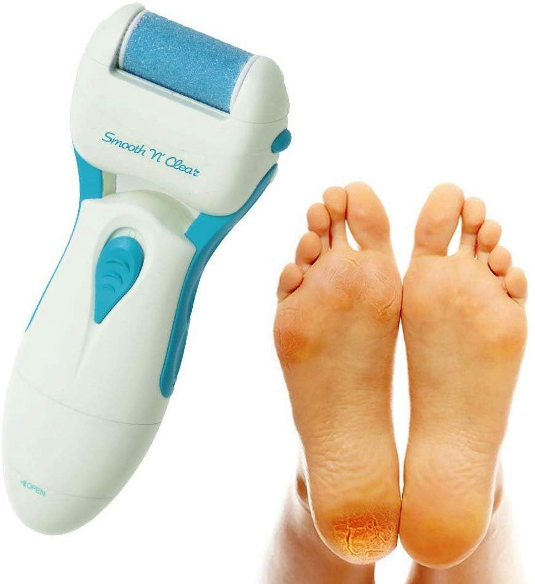 Quality at Home Electric Callus Remover Blue