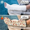 thumbnail image 7 of COEQINE Mushroom Leg Cast Covers Broken Leg Shower Cast Cover Leg Plaster Sleeve Large Washable Cast and Bandage Protector Reusable Leg Cast Covers for Shower Adult, 7 of 7