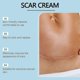 thumbnail image 3 of Silicone Scar Sheets, Silicone Scar Tape, Silicone Scar Strips, Professional Scar Removal Sheets for Surgical Scars, C-Section, Burn et, 3 of 5