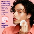 thumbnail image 4 of Clean & Clear Essentials Oil-Free Acne Toner, Salicylic Acid, 8 fl. oz, 4 of 8
