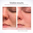 thumbnail image 4 of Vaporizador facial Colorfarm Nano Ionic Smart Face Steamer, 4 of 7
