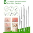 thumbnail image 4 of 15 PCS Blackhead Remover Pimple Popper Tool Kit,Black Head Removal Extractor for Acne Comedone Whitehead Popping Zit Blemish Facial Skin Care Tools with Metal Case, 4 of 7