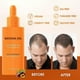 thumbnail image 5 of Pure Natural Hair Growth Oil Blend with Rosemary & Castor for Thicker Stronger Hair, 5 of 5